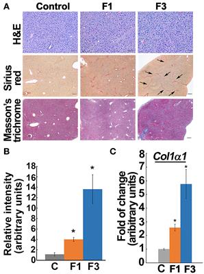 Augmented Liver Uptake of the Membrane Voltage Sensor Tetraphenylphosphonium Distinguishes Early Fibrosis in a Mouse Model